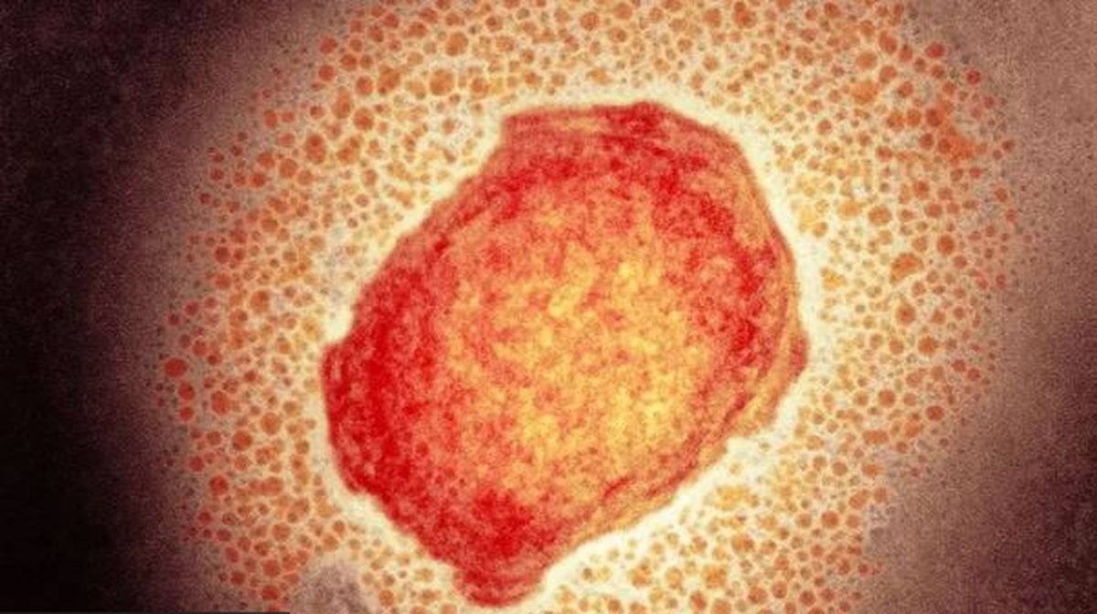 Viruela del mono: confirmaron el primer caso del virus en el país