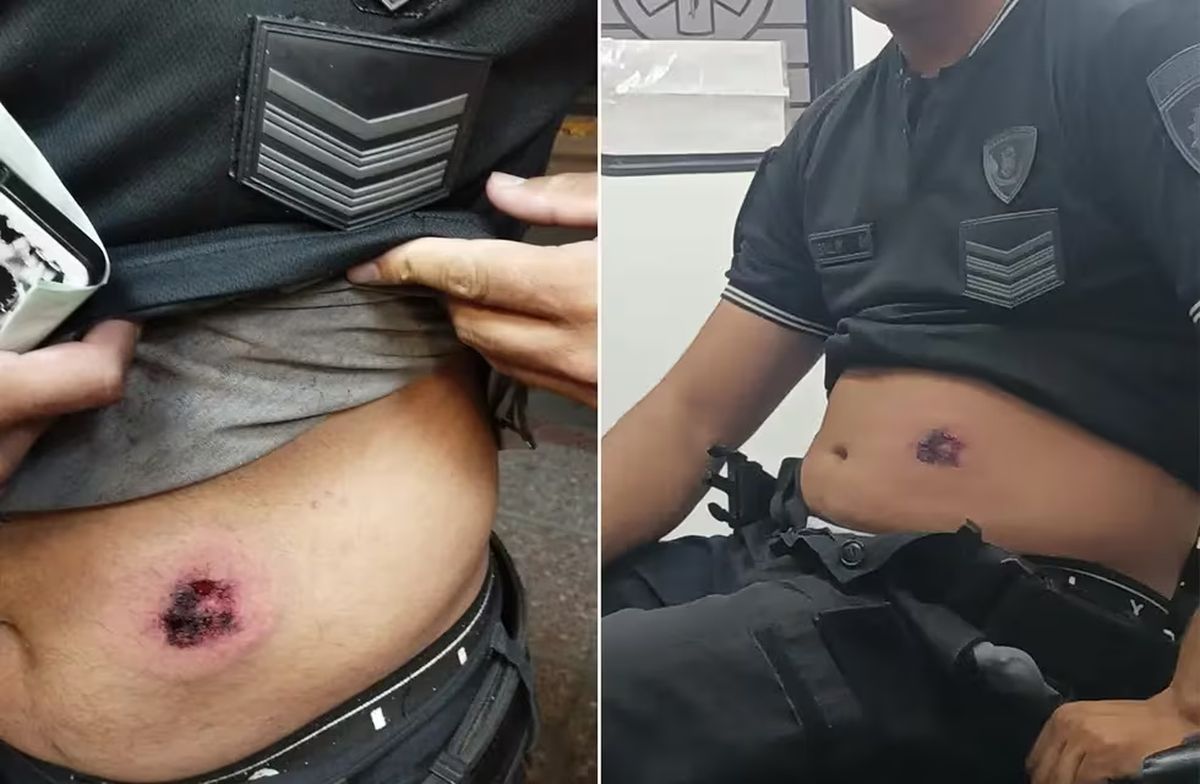 La herida que la bala le dejó en el abdomen del oficial. Foto: Policía de Córdoba.