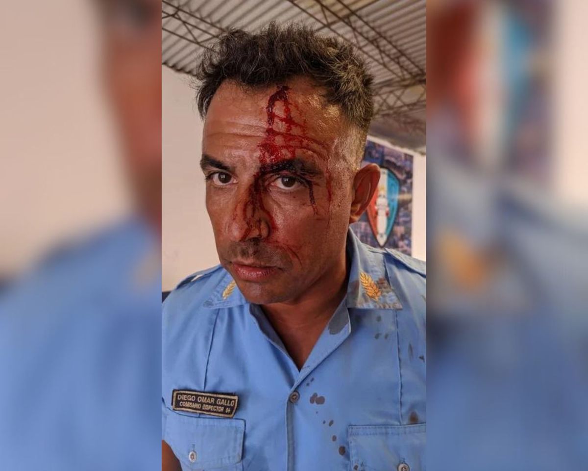 El policía debió recibir tres puntos de sutura por la herida. Foto: Policía de Córdoba.